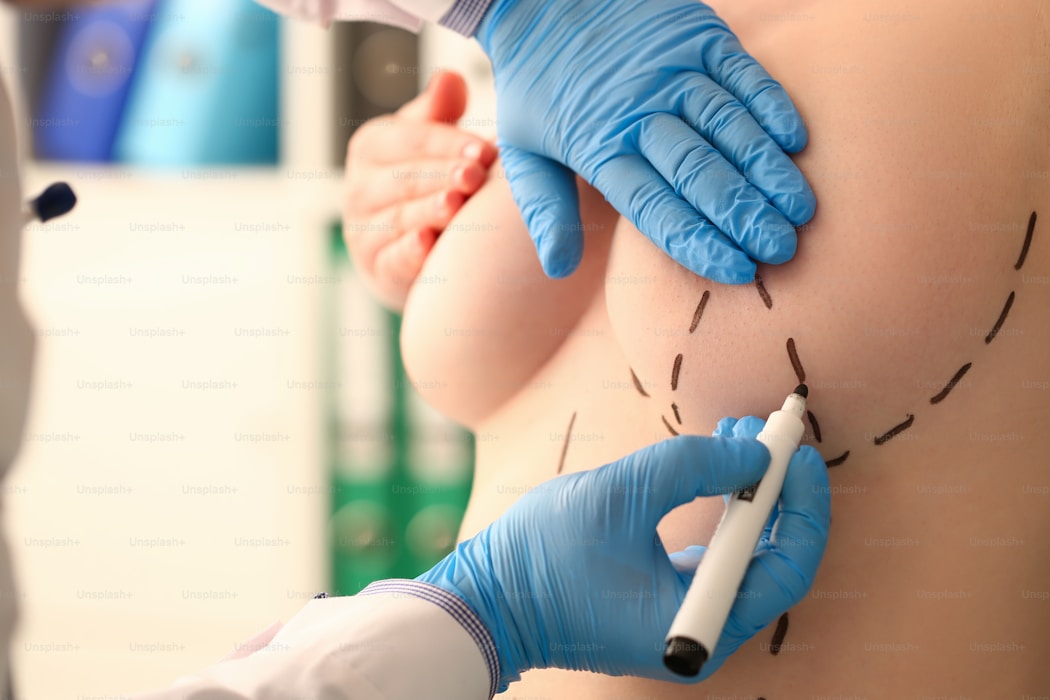 Breast implant removal