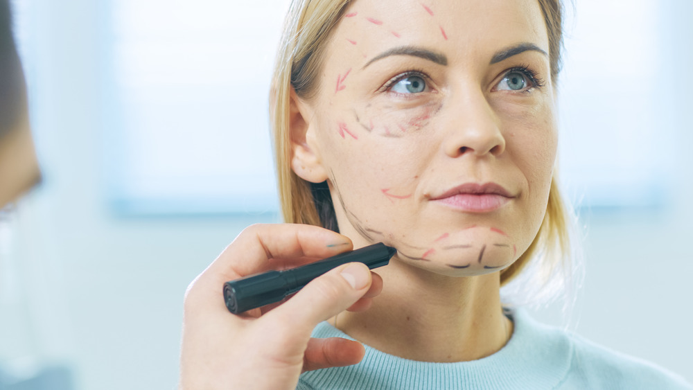 A woman preparing for a facelift procedure